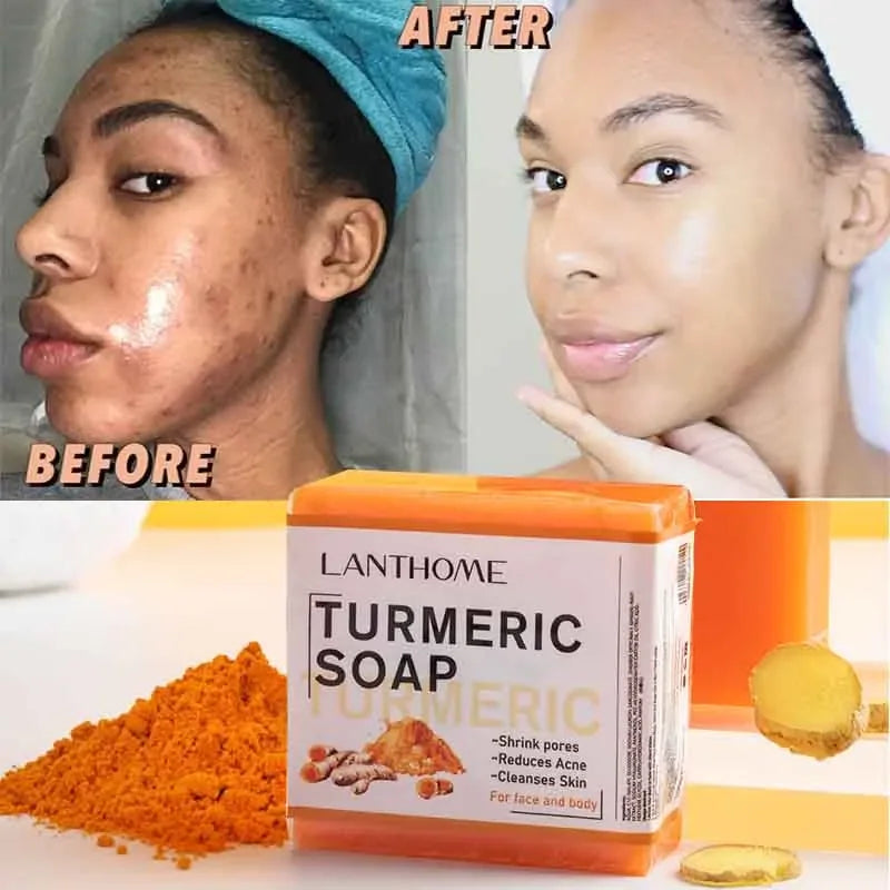 Turmeric Face Cleansing Anti Acne Soap