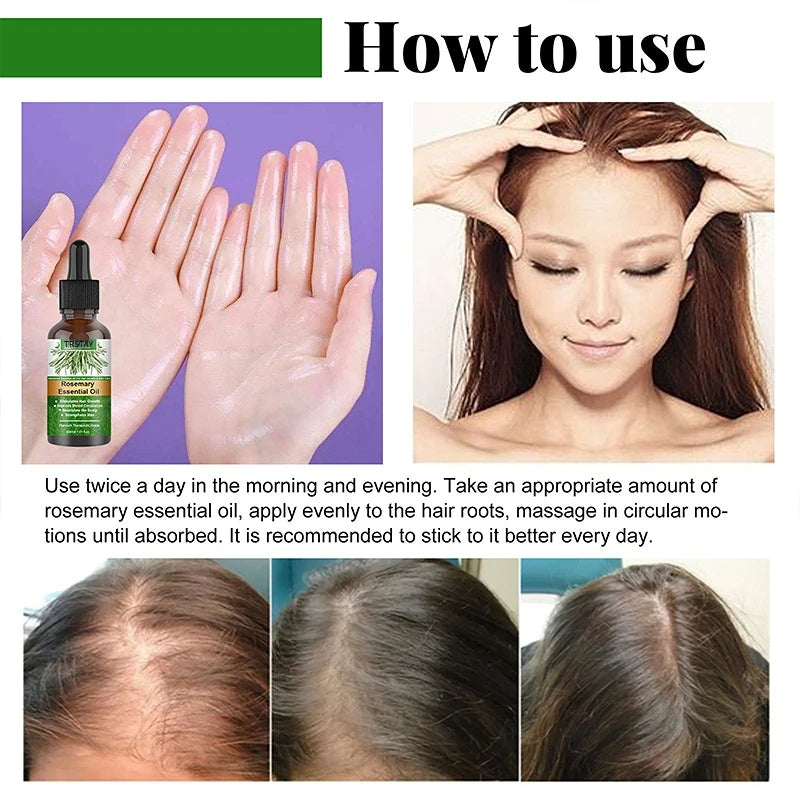 Rosemary Essential Oil Anti-frizz Anti Hair Loss oil